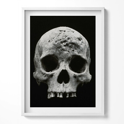 Obraz w ramce Ludzka czaszka szkielet